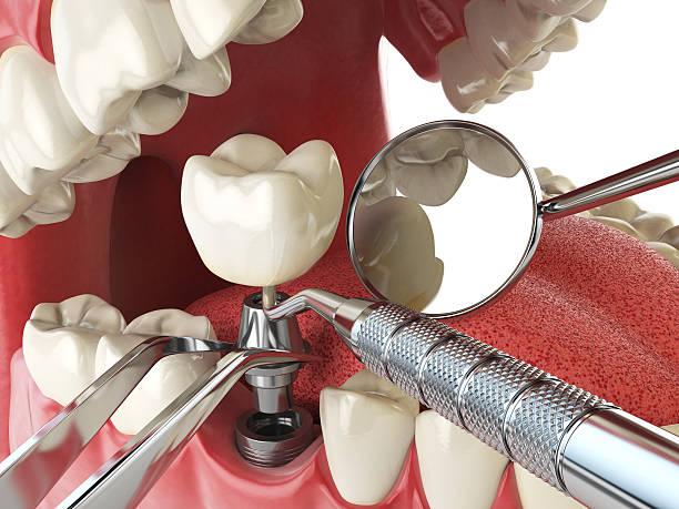 Best Emergency Dental Care for Sports Injuries in Maywood Park, OR