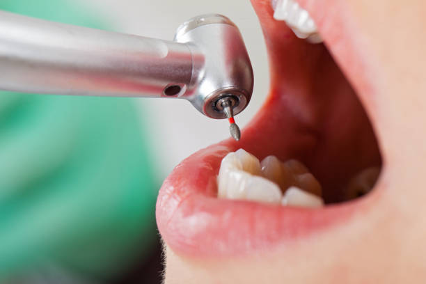 Best Emergency Treatment for Jaw Pain or Injury in Maywood Park, OR
